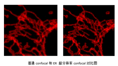 尼康生物影像中心超分辨激光扫描共聚焦显微镜线上培训通知